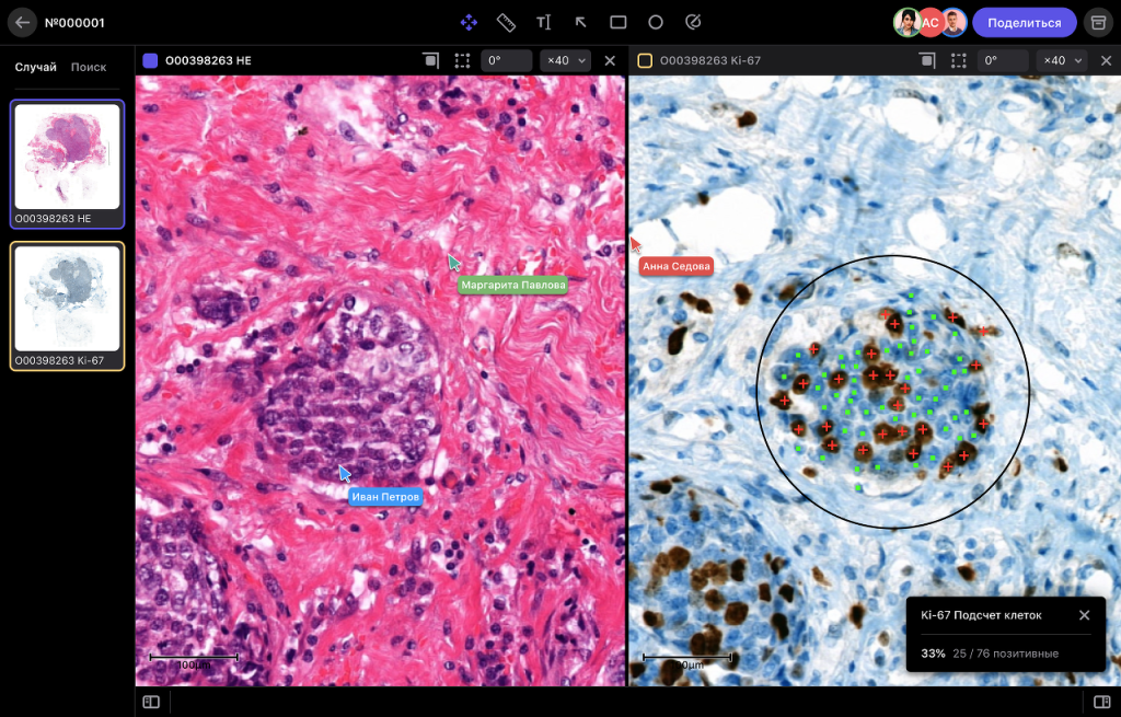 «Ростех» представил первый серийный российский сканер микропрепаратов на базе ИИ - 2